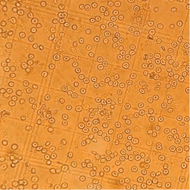 Discovery of AG-270, a First-in-Class Oral MAT2A Inhibitor for the Treatment of Tumors with Homozygous MTAP Deletion