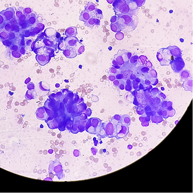 Boosting mRNA Therapeutics: pHLIP Enhances Endosomal Escape and Gene Expression in Lipid Nanoparticle