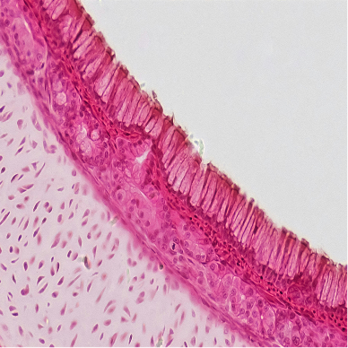 Exploration of a Class of Aryl Imidazolyl Ureas As Potent Acid Ceramidase Inhibitors for the Treatment of Fibrotic Diseases